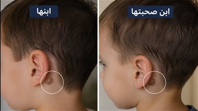 ابني وابن أقرب صاحبة ليا اتولدوا بنفس الوحمة حكايات صابرين محمد
